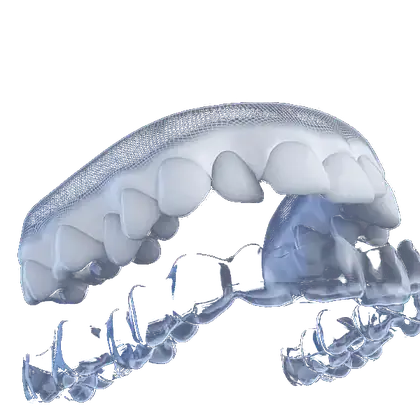 Dientes alineándose con un alineador transparente Invisalign