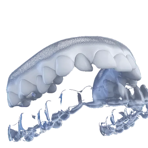 Dientes alineándose con un alineador transparente Invisalign